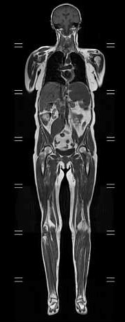 Whole Body Imaging