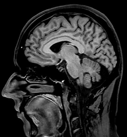 3D BRAIN VIEWg