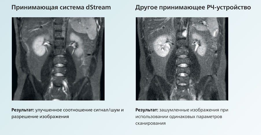 Технологія dStream