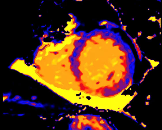 Cardiac QUANT