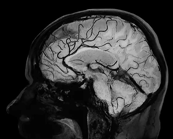 Техніка сканування Black Blood Imaging