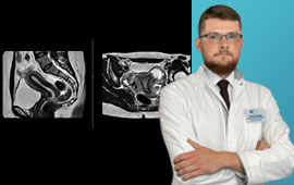 "Medicum-community" 3. Сучасні можливості МРТ у діагностиці ендометріальної карциноми