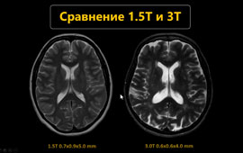 Зустріч 1. Сучасні можливості МРТ у неврології: головний мозок